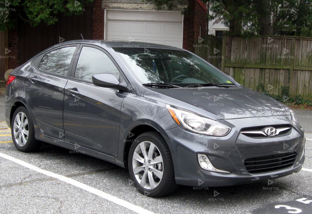 Регулировка селектора АКПП Hyundai Accent в Улан-Удэ Регулировка селектора АКПП Hyundai Accent в Улан-Удэ